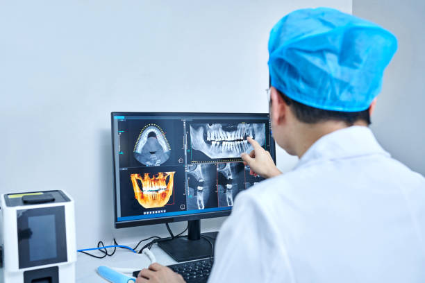 Best Emergency Wisdom Tooth Extraction in Rkville, PA