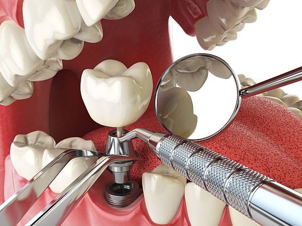 Best Emergency Treatment for Jaw Pain or Injury in Rkville, PA